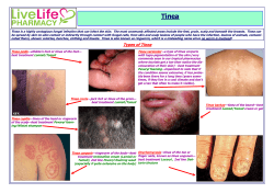 information about Tinea - LiveLife Pharmacy