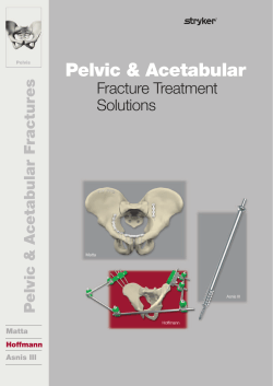 Pelvic Acetabular Fracture Treatment Solutions - Stryker